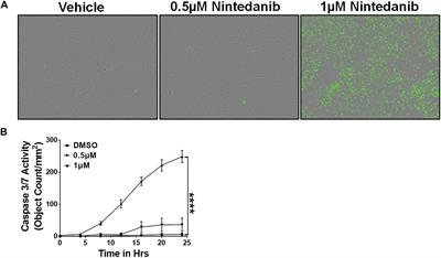 Dysregulation of Mesenchymal Cell Survival Pathways in Severe Fibrotic Lung Disease: The Effect of Nintedanib Therapy